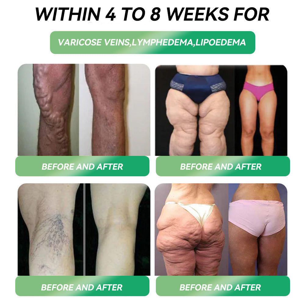 ๐ฟCroaieยฎ Extragastric Gastric Bypass Ultra-Concentrated Serum Beads๐ฟ - ๐๐จ๐ฅ๐ฒ๐๐จ๐ฉ๐๐ฆ๐ข๐ง๐ & ๐๐ฎ๐จ๐๐๐ง๐๐ฅ ๐๐จ๐๐ญ๐ข๐ง๐ & ๐๐๐+ & ๐๐จ๐ซ๐ข๐ง๐ ๐ (โ
๐ฌ๐ฎ๐ซ๐ ๐ข๐๐๐ฅ ๐๐๐๐๐๐ญ๐ฌ ๐ฐ๐ข๐ญ๐ก๐จ๐ฎ๐ญ ๐ฌ๐ฎ๐ซ๐ ๐๐ซ๐ฒ, ๐๐๐% ๐ฆ๐ฎ๐ฌ๐๐ฅ๐ ๐ฉ๐ซ๐๐ฌ๐๐ซ๐ฏ๐๐ญ๐ข๐จ๐ง, ๐๐๐๐ซ๐๐ฌ๐ฌ๐ข๐ง๐ ๐จ๐๐๐ฌ๐ข๐ญ๐ฒ) โ