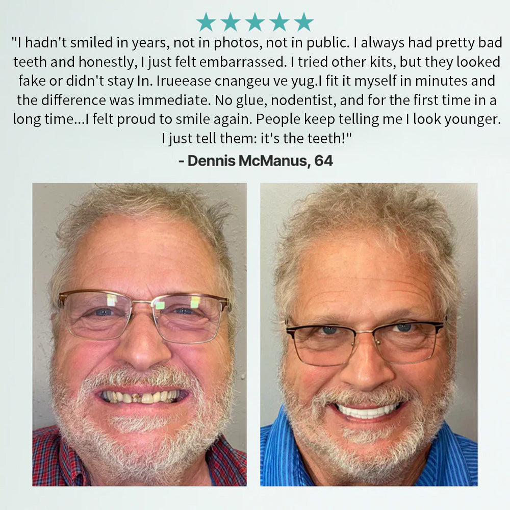 🦷Hermsa® Advanced Customized Full Denture Set(✅Clinically backed comfort-fit dentures — Trusted by 8,000+ UK users for all-day comfort.)