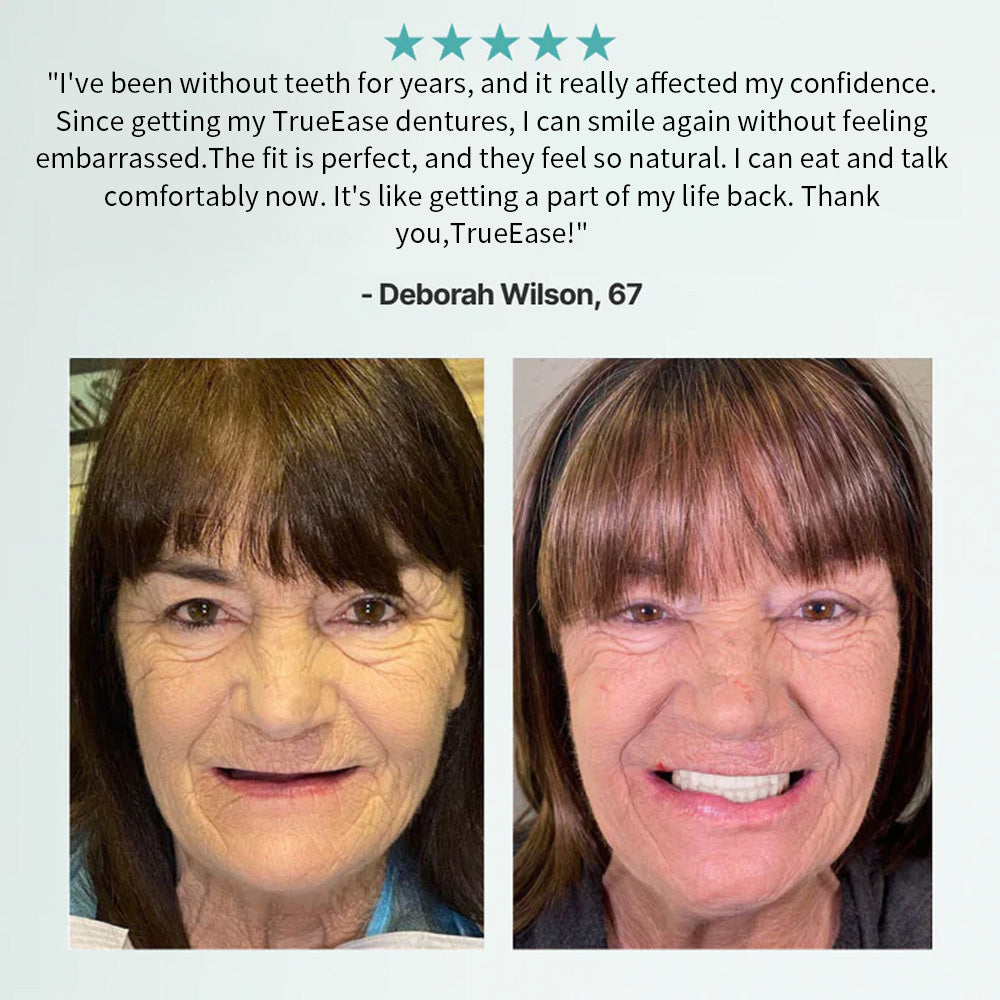 🦷Hermsa® Advanced Customized Full Denture Set(✅Clinically backed comfort-fit dentures — Trusted by 8,000+ UK users for all-day comfort.)