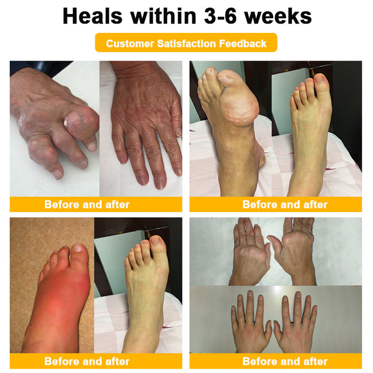 LOTMAY® Bee Venom Pain-Relief Bone Healing Cream 🐝🐝(Specially for older adults & NHS recommends)