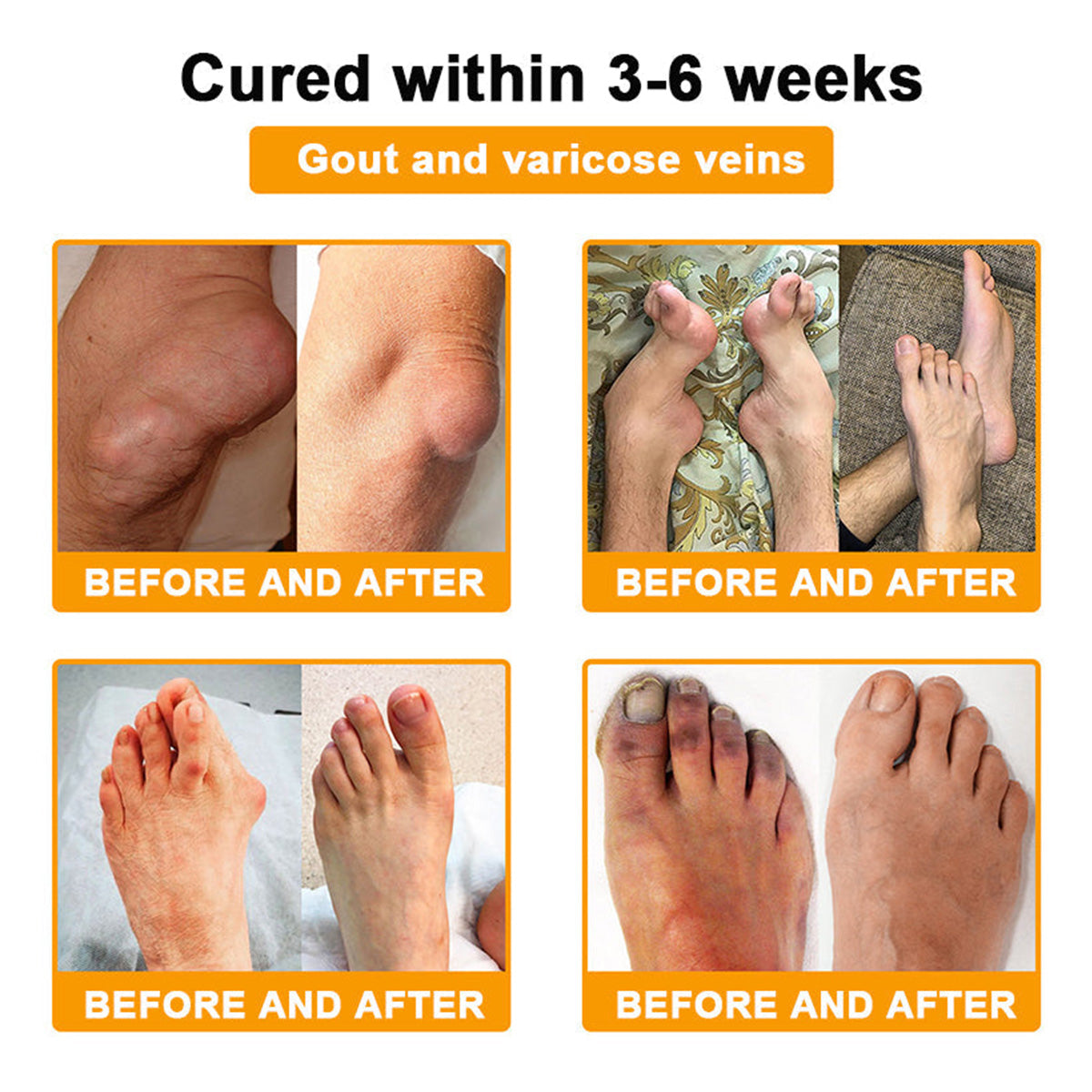 LOTMAY® Bee Venom Pain-Relief Bone Healing Cream 🐝🐝(Specially for older adults & NHS recommends)