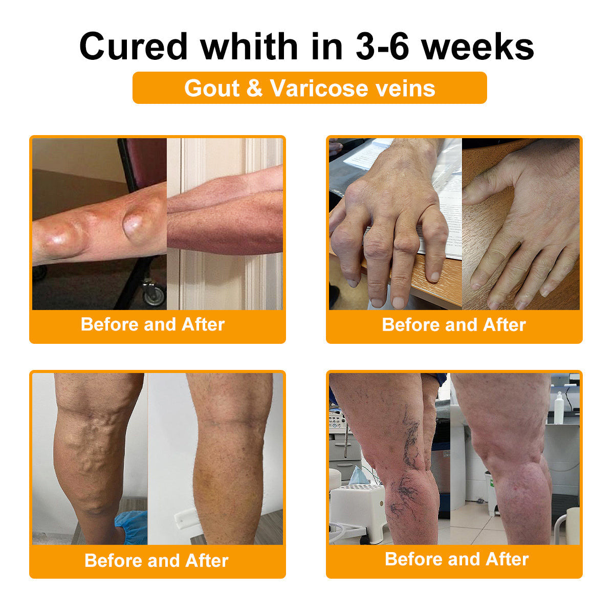 LOTMAY® Bee Venom Pain-Relief Bone Healing Cream 🐝🐝(Specially for older adults & NHS recommends)
