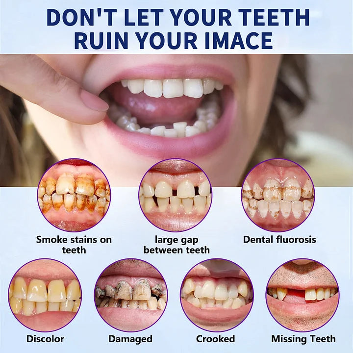 🦷Hermsa®-🦷Advanced Customized Full Denture Set🦷 (⏰Limited time discount last 30 minutes⏰)