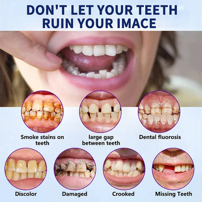 🦷Hermsa®-🦷Advanced Customized Full Denture Set🦷 (⏰Limited time discount last 30 minutes⏰)