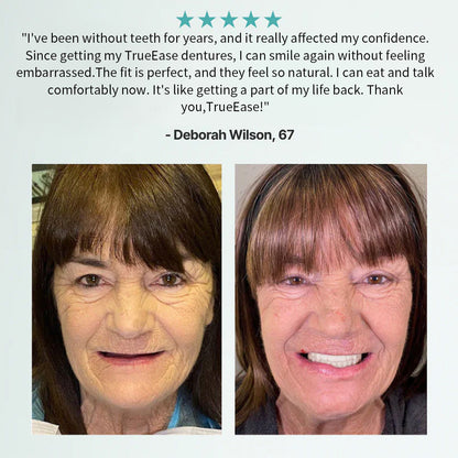 🦷Hermsa® Advanced Customized Full Denture Set（✅Clinically backed comfort-fit dentures —  Trusted by 8,000+ UK users for all-day comfort.）