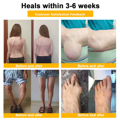 LOTMAY® Bee Venom Pain-Relief Bone Healing Cream 🐝🐝(Specially for older adults & NHS recommends)