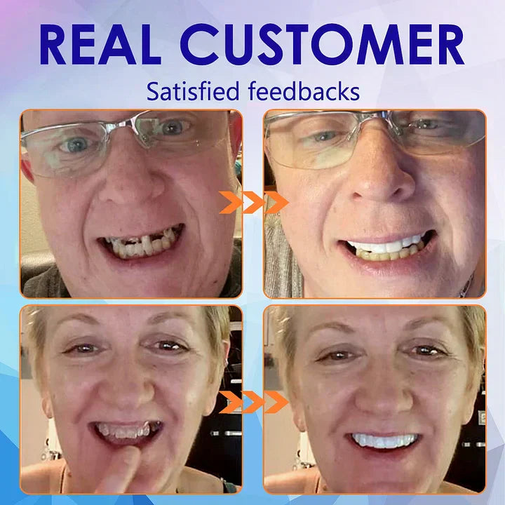 🦷Hermsa®-🦷Advanced Customized Full Denture Set🦷 (⏰Limited time discount last 30 minutes⏰)