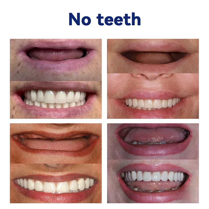 🦷Hermsa®-🦷Advanced Customized Full Denture Set🦷 (⏰Limited time discount last 30 minutes⏰)