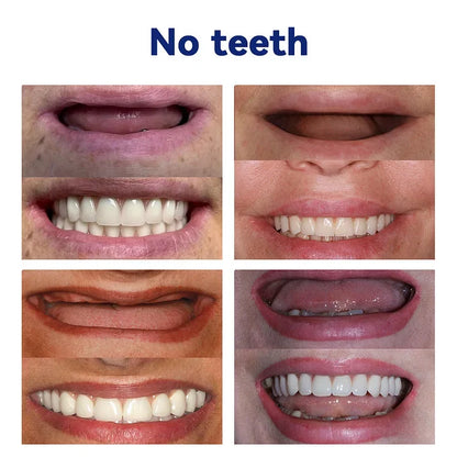 🦷Hermsa®-🦷Advanced Customized Full Denture Set🦷 (⏰Limited time discount last 30 minutes⏰)
